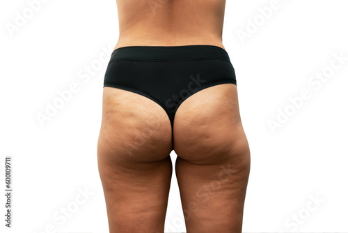 Cropped shot of young tanned woman in black panties with cellulite from a weight loss or weight gain on thighs isolated on a white background. Excess weight, overweight. Stagnation of lymph