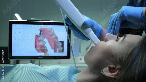 Doctor scans the patient\'s teeth in the clinic. The dentist holds in his hand a manual 3D scanner for the jaw and mouth. Dental health. Creates a 3D model of teeth and gums on a medical monitor