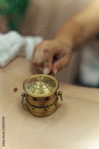 Moxibustion treatment: Traditional Chinese medicine tools for heating acupuncture point therapy. chinese herbal medicine Copper moxibustion burner box with herbal moxa sticks in holistic clinic.