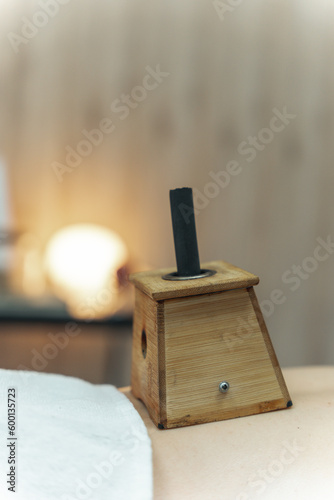 Moxibustion treatment: Traditional Chinese medicine tools for heating acupuncture point therapy. chinese herbal medicine Copper moxibustion burner box with herbal moxa sticks in holistic clinic.