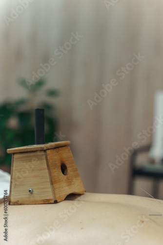 Moxibustion treatment: Traditional Chinese medicine tools for heating acupuncture point therapy. chinese herbal medicine Copper moxibustion burner box with herbal moxa sticks in holistic clinic.