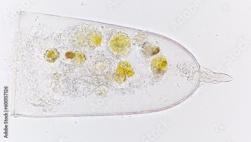 Marine tintinnid ciliate known as Favella sp. Stacked photo photo