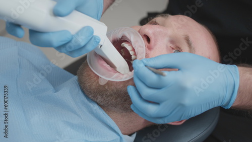 Close up: Doctor scans the teeth of a male patient in the medical office of clinic. The dentist holds in his hand a manual 3D scanner for the jaw and mouth. Dental health