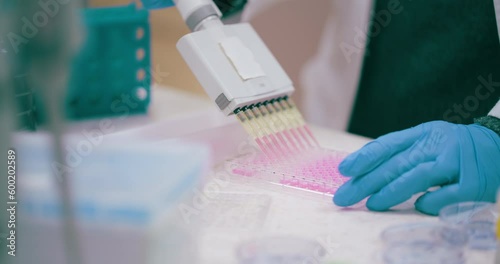 Laboratory worker researcher conducting research on cancer photo
