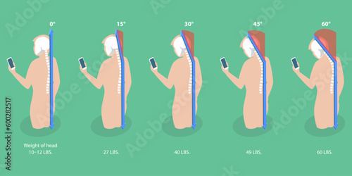 3D Isometric Flat Vector Conceptual Illustration of Phone Posture, Stage Text Neck Syndrome