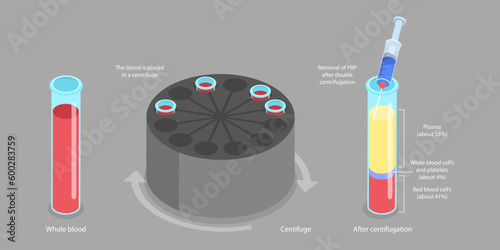 3D Isometric Flat Vector Conceptual Illustration of Platelet-rich Plasma, Regenerative Medicine