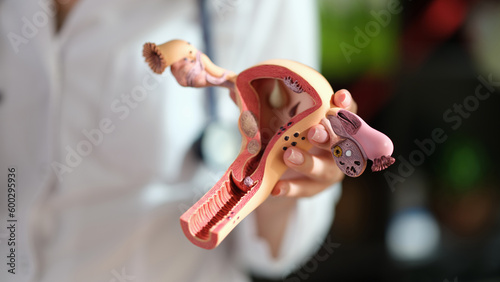 Fényképezés Woman gynecologist holding anatomical model of uterus and ovaries