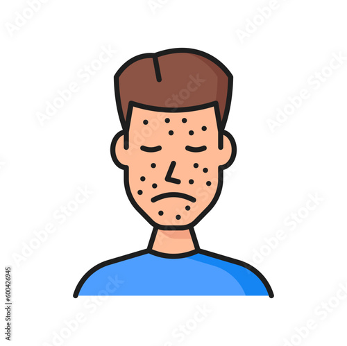 Allergy acne or urticaria color line icon. Allergic reaction, dermatology disease or skin problem caused by allergen, food or seasonal allergy symptom outline vector symbol with rash on man face