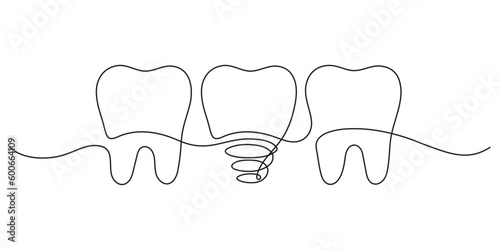 Teeth row with healthy and implant tooth, continuous art line drawing. Dentistry health. Vector hand drawn