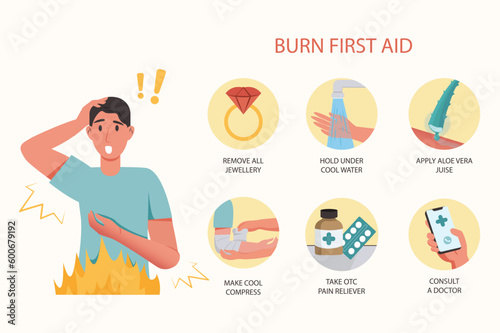 Medical examination concept burn first aid with people scene in the flat cartoon style. Instructions on how to provide first aid for burns. Vector illustration.