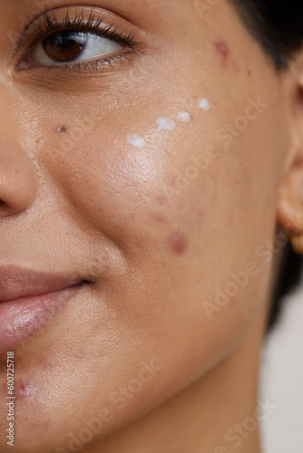 Close-up of young woman face with cream