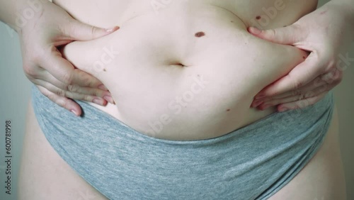 Close-up of fat folds on the large belly of an overweight woman. Concept of overweight, female obesity, dieting and overweight problems.