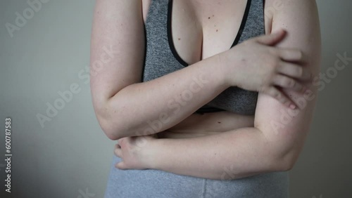 Fat folds on the body of an overweight woman. Concept of overweight, female obesity, dieting and overweight problems. Complexes, fear of appearance, shame.
