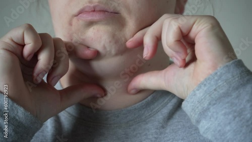 A hand squeezing the layered skin under the neck, problematic sagging of adipose tissue hanging under the chin of a woman, health care concept. photo