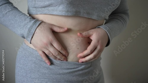Close-up of fat folds on the large belly of an overweight woman. Concept of overweight, female obesity, dieting and overweight problems.