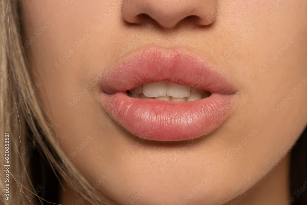 Part of face, Young woman close up. Sexy plump lips without makeup Part of face, Young woman close up. Sexy plump lips without makeup