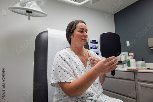 Horizontal image of young 30s dermatology patient examines possible basal cell carcinoma excision location on female chest. photo