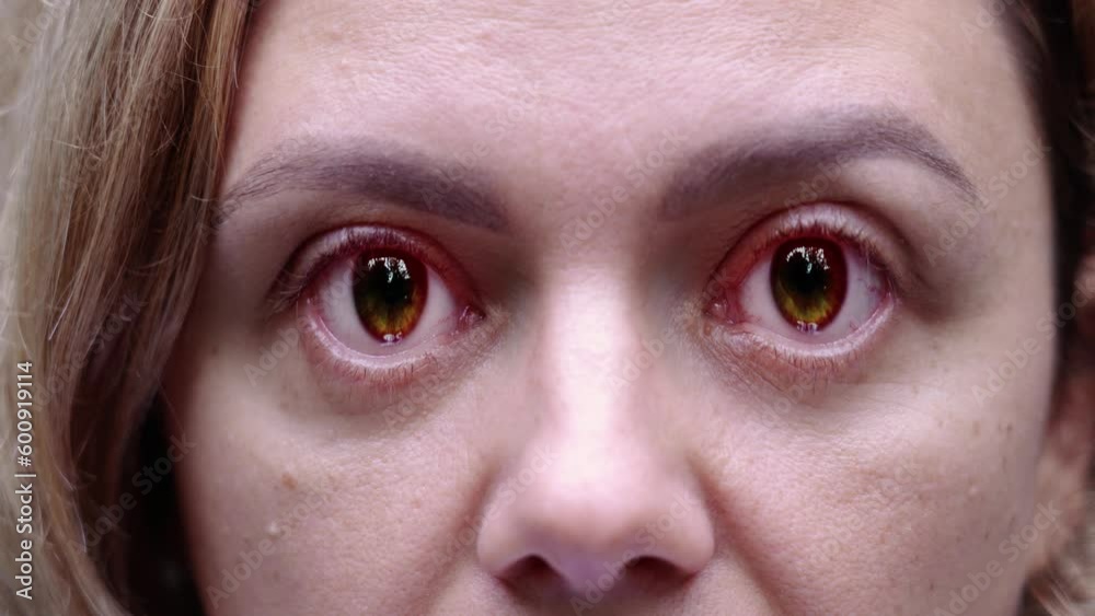 Woman stares at camera with huge eyes changes color to black
