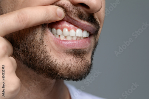 Tableau sur toile Man showing healthy gums on gray background, closeup