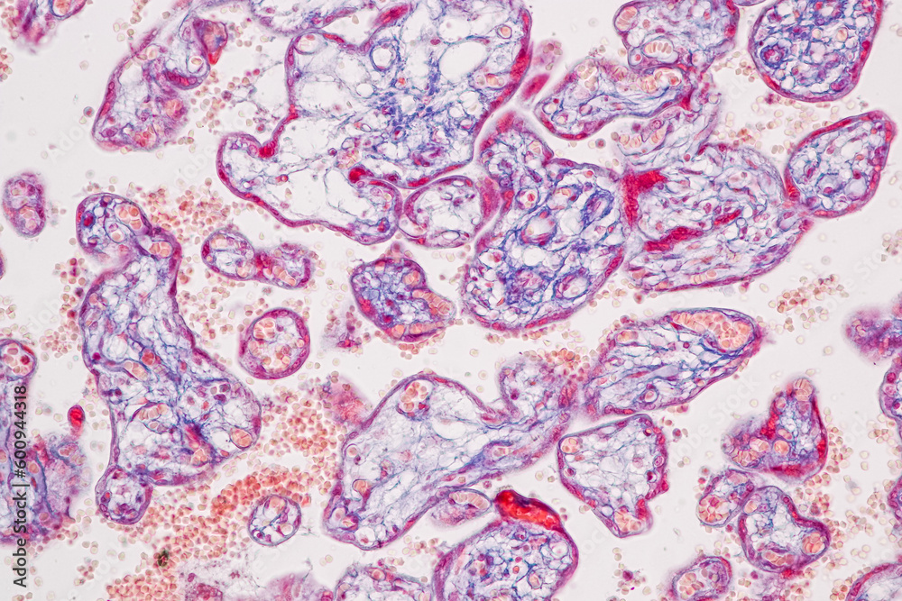 Naklejka premium Histological Uterus human, Uterine tube human, Placenta human and Umbilical cord Human under the microscope for education.