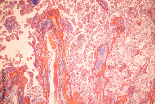 Canvastavla Histological Uterus human, Uterine tube human, Placenta human and Umbilical cord Human under the microscope for education
