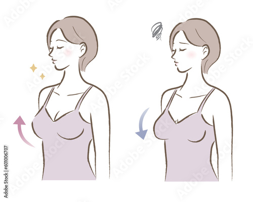 ハリのあるバストと垂れたバストの女性のイラスト　ビフォーアフター	