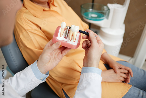 Close-up of unrecognizable dentist holding tooth model while explaining dental implant surgery to patient in clinic photo