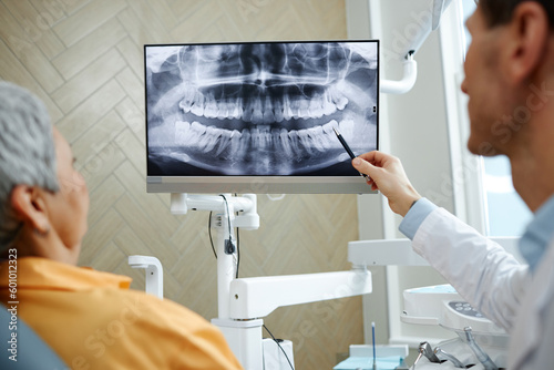 Back view close-up of male dentist pointing at teeth X-ray image on screen during consultation on dental surgery in clinic
