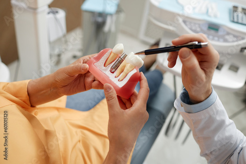 Canvastavla Close-up of unrecognizable senior woman holding tooth model during consultation