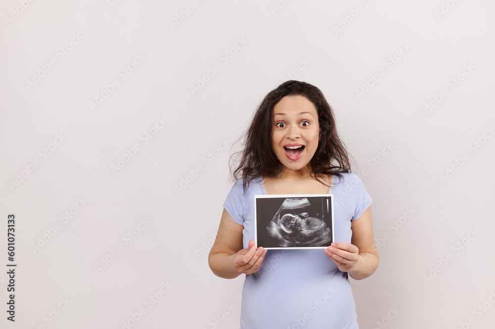 Isolated emotional portrait on white background of happy amazed pregnant woman showing ultrasound scan of her newborn baby, expressing positive emotions from pregnancy. People. Gynecology. Diagnostics Isolated emotional portrait on white background of happy amazed pregnant woman showing ultrasound scan of her newborn baby, expressing positive emotions from pregnancy. People. Gynecology. Diagnostics