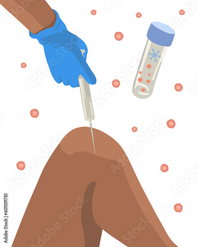 Vector isolated illustration of stem cell treatment. Stem cells in a test tube. Stem cells are injected into the knee.