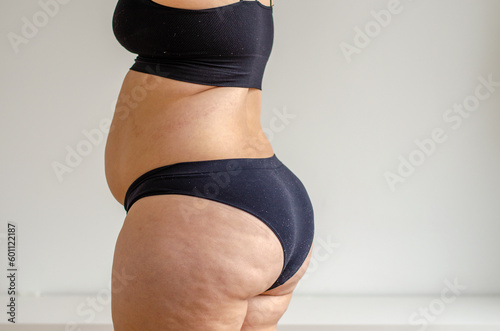 Overweighted woman wearing bikini seen from back