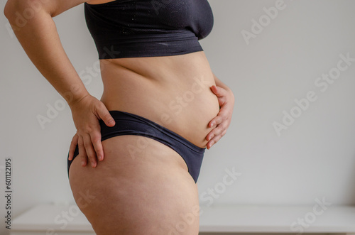 Overweighted woman wearing bikini seen from side