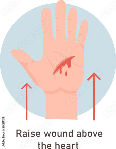 Wounds First Aid