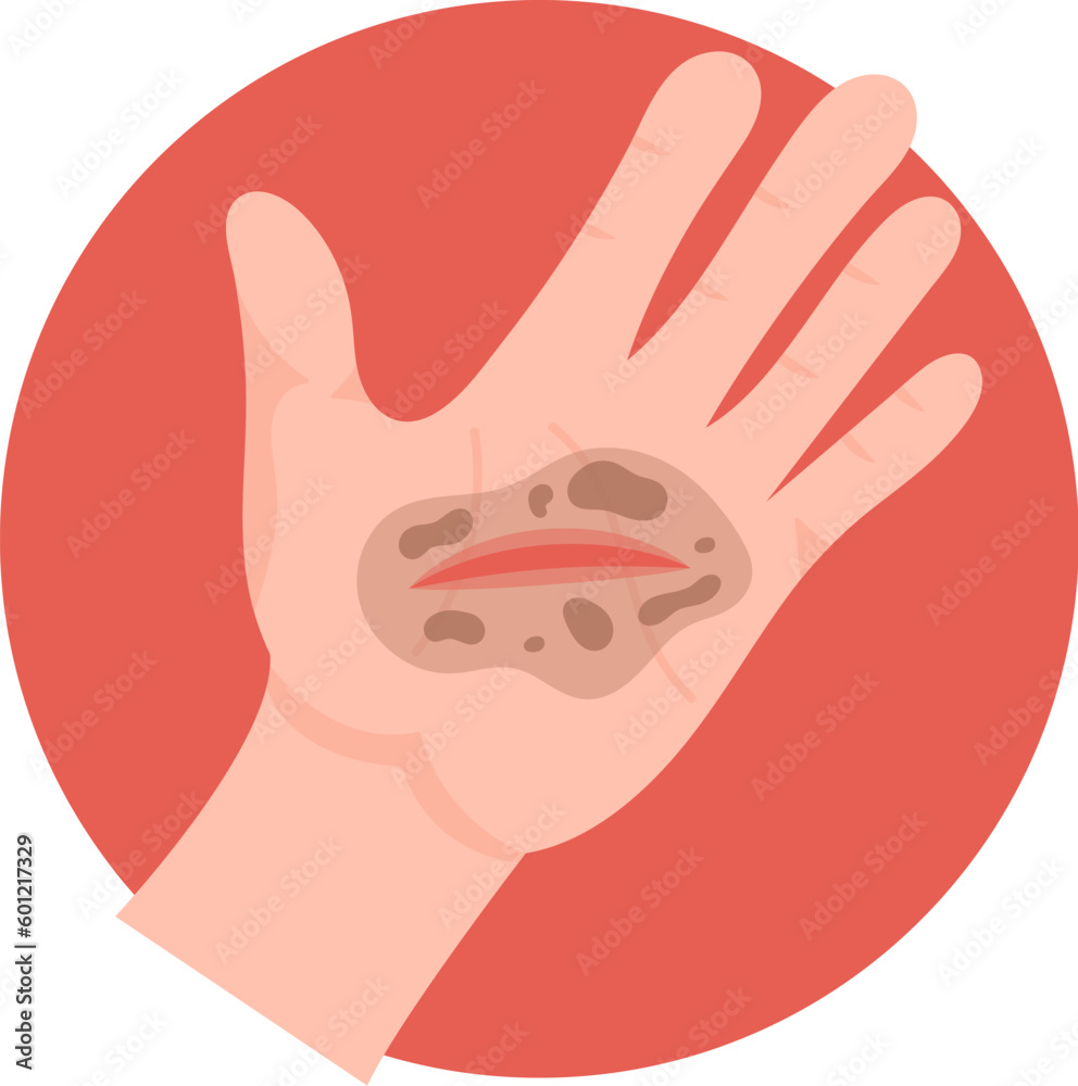 Obraz premium Dirt In The Wound On Hand