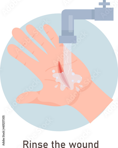 Wounds First Aid With Water