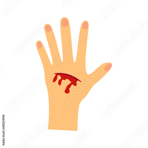 Wounded hand on the back of a bleeding palm on a white background. vector illustration