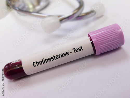 Blood sample isolated for Cholinesterase test to determine the levels of acetylcholinesterase and pseudocholinesterase in the blood. Close view. photo