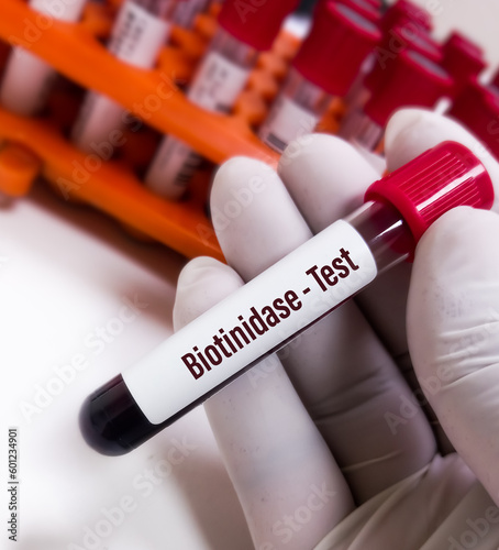 Blood sample for Biotinidase blood test to diagnosis of Biotinidase deficiency. It's an inherited disorder in where the body is unable to recycle the vitamin H or biotin. photo