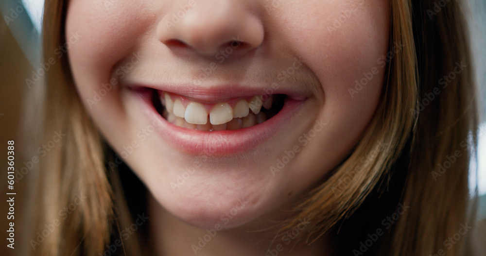 Close-up. Portrait of happy little girl bursting. Beautiful child looking at the camera and smiling. Woman's smile before and after teeth whitening. Close-up. Portrait of happy little girl bursting. Beautiful child looking at the camera and smiling. Woman's smile before and after teeth whitening.