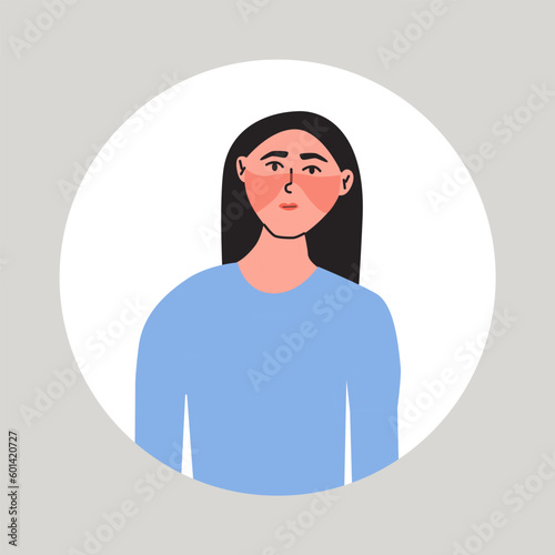 Young women suffering from a flushed face. Female with health problem. Hot flashes, symptom of menopause. Flat vector medical illustration