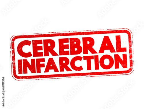 Cerebral infarction - pathologic process that results in an area of necrotic tissue in the brain, text concept for presentations and reports