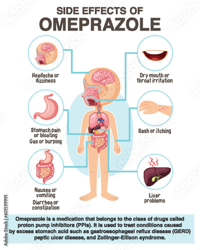 Human anatomy diagram cartoon style of Omeprazole side effects