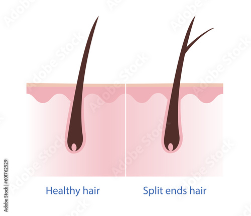 Healthy hair and split ends hair with scalp layer vector on white background. Hair care concept illustration.