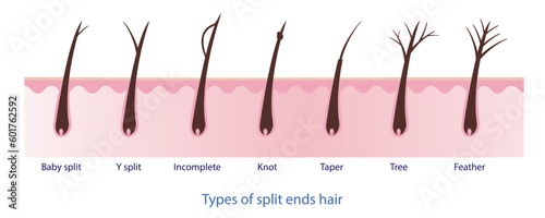 Types of split ends hair, baby split, y split, incomplete, knot, taper, tree, feather with scalp layer vector on white background. Hair care concept illustration.