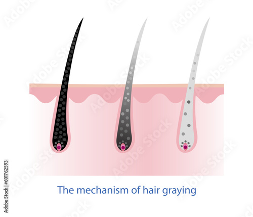 The mechanism of hair graying with scalp layer vector isolated on white background. Hair anatomy, hair structure, hair care concept illustration.