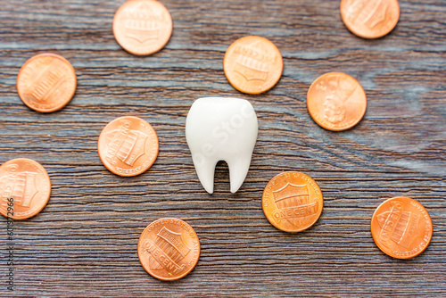 Dental Expenses Concept: Tooth Model Among Scattered Coins