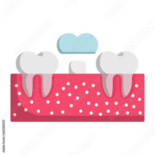Fixed-Fixed teeth restoration vector color icon design, Dentistry symbol, Healthcare sign, Dental instrument stock illustration, Traditional dental bridge concept