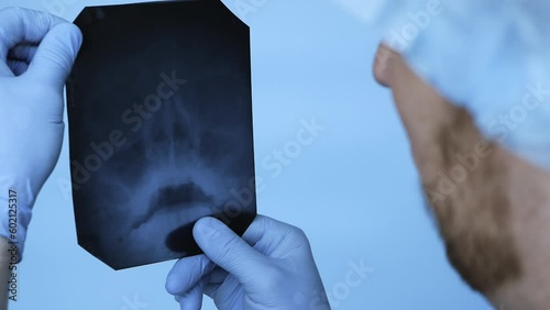 The doctor in the clinic carefully diagnoses a person's craniocerebral injury or nasopharynx. X-ray of a human nose. A doctor in a worker's office makes a diagnosis of a disease. Renten of a human photo