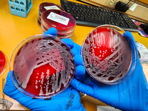 Fotótapéta Staphylococcal bacterial colonies on blood agar culture plates